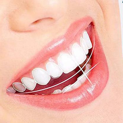 SMILEPRO® – Zâmbet perfect instantaneu – Ofertă exclusivă 2 la preț de 1