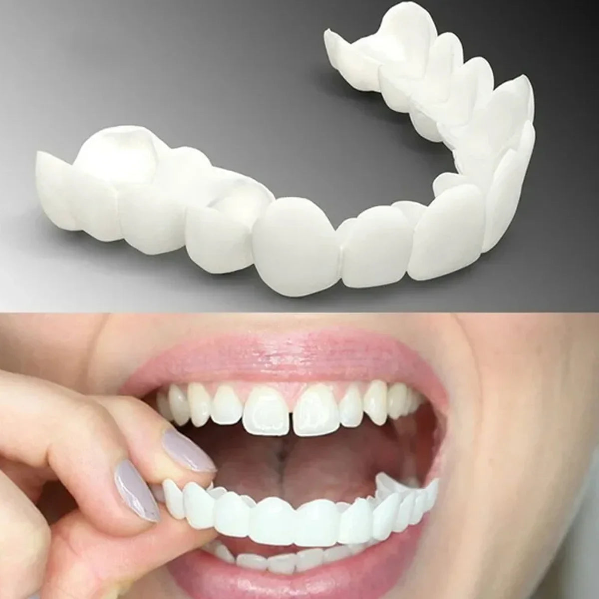 SMILEPRO® – Zâmbet perfect instantaneu – Ofertă exclusivă 2 la preț de 1