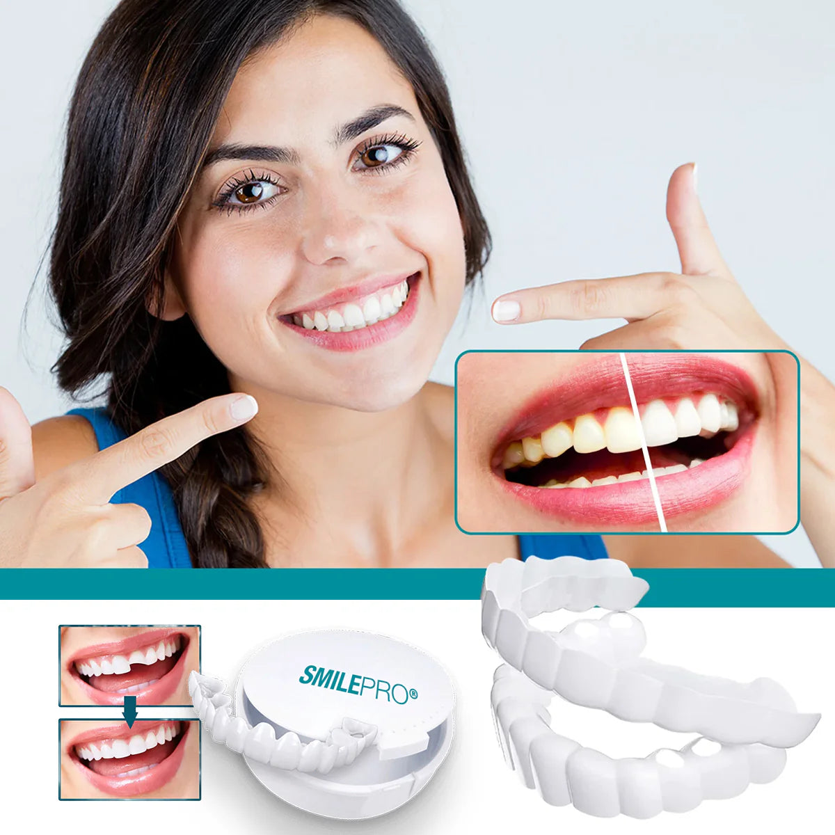 SMILEPRO® – Zâmbet perfect instantaneu – Ofertă exclusivă 2 la preț de 1