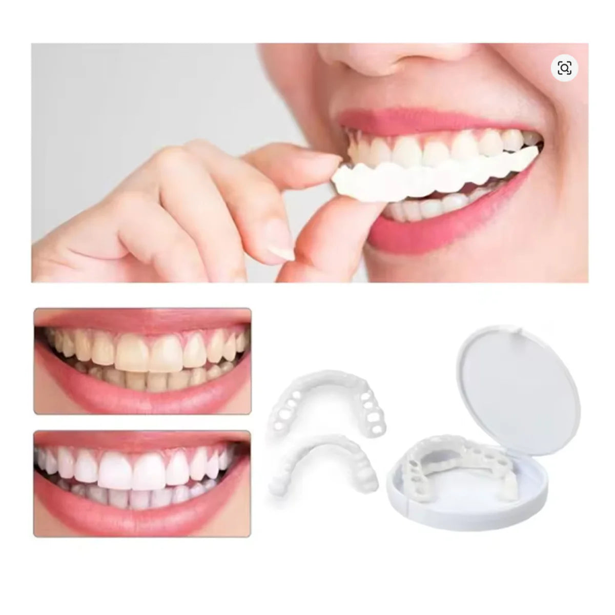 SMILEPRO® – Zâmbet perfect instantaneu – Ofertă exclusivă 2 la preț de 1