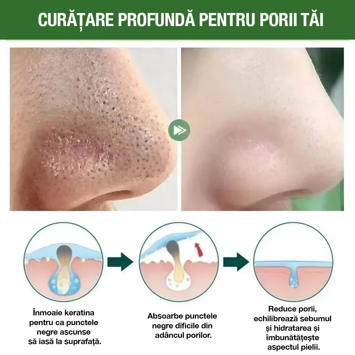 GreenMask® - Curățare facială profundă (Ofertă 2 la preț de 1)
