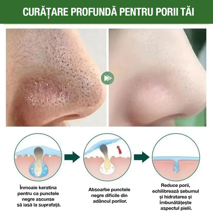 GreenMask® - Curățare facială profundă (Ofertă 2 la preț de 1)